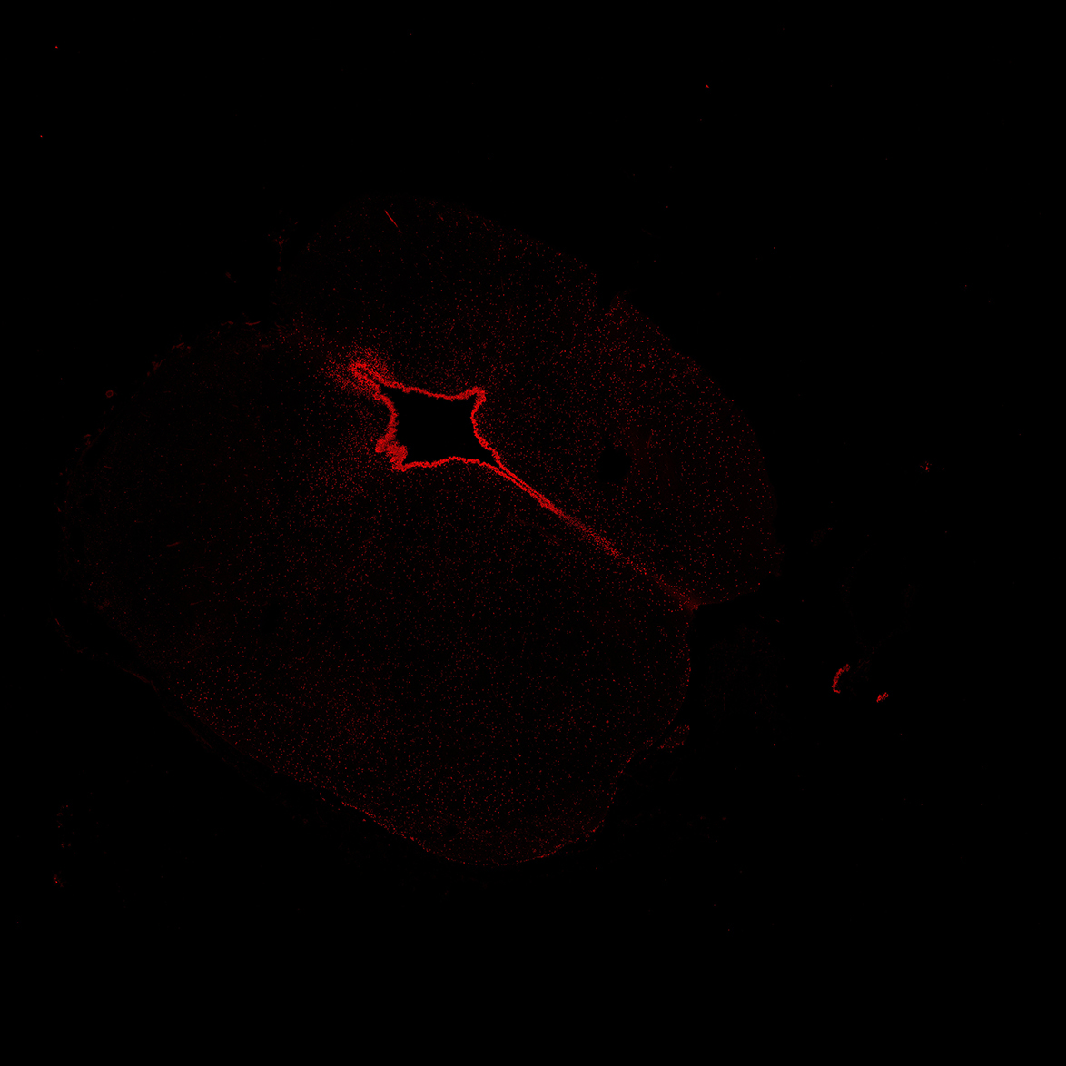 Human foetal midbrain